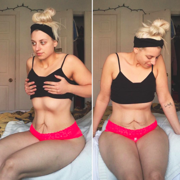 A body positive blogger has shared an empowering message about learning to love her loose skin [Photo: Instagram/omgkenzieee]