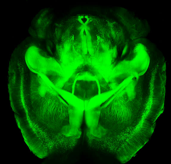 An intact mouse brain imaged via a new technique called CLARITY, which reveals fine details and the big picture at the same time.