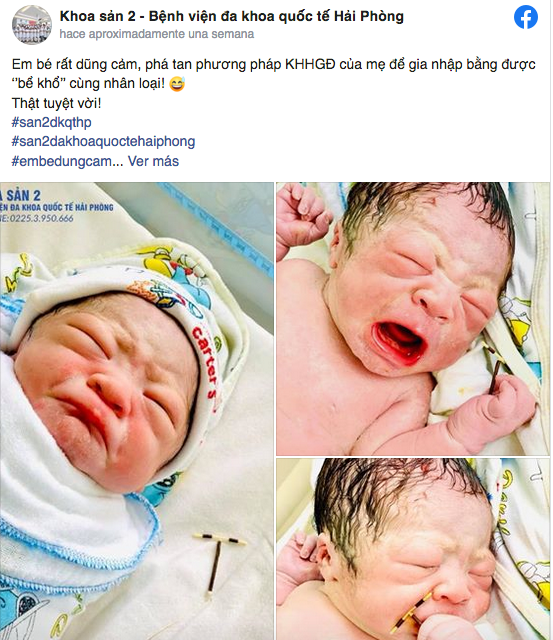 El bebé nació con el DIU de su madre en la mano y el médico no pudo evitar inmortalizar el momento. (Foto: Facebook / Hai Phong International Hospital)