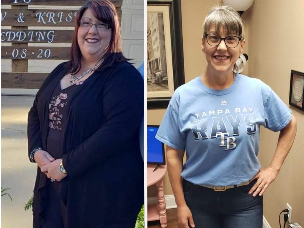 Before and after pictures that show Tara Rothenhoefer's weight loss of 176 pounds.