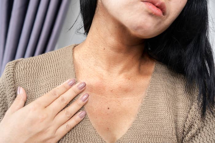 Close-up of a woman touching her neck and upper chest, showing skin irritation and mole