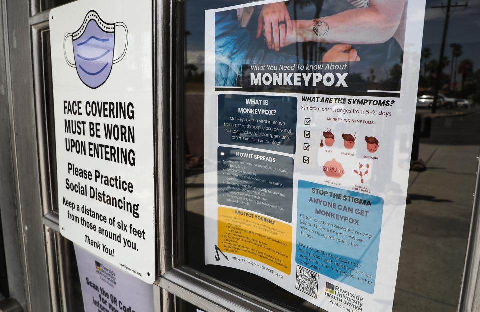 Informational signs about monkeypox are posted at the front entrance to the All Worlds Resort in Palm Springs, Calif., August 8, 2022. 