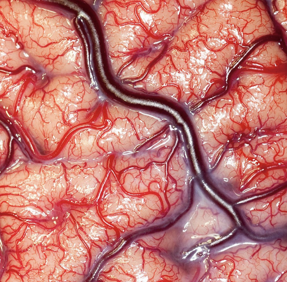 Close-up of human brain tissue with blood vessels visible
