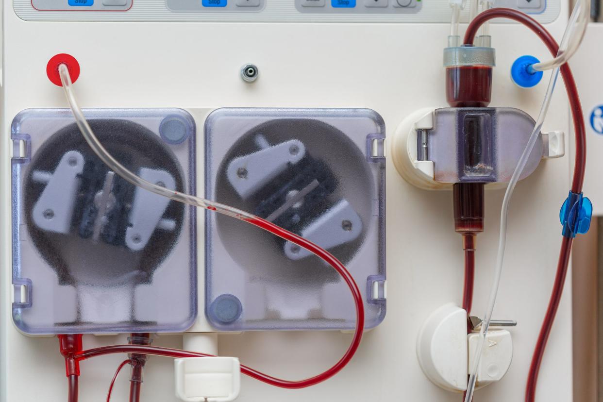 Artificial kidney. Blood transfusion