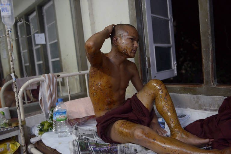 A Buddhist monk injured in a crackdown on a protest at a Chinese-backed copper mine in Monywa, northern Myanmar, is shown December 3, 2012 resting at a hospital. Myanmar police used phosphorus against a rally at a copper mine last year, a parliamentary report led by Aung San Suu Kyi said Tuesday, in the harshest crackdown yet on protest under the reformist regime