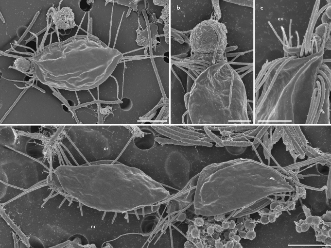 Electron microscopy images of a new species of hemimastigote (Nature)