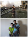 This combo of two photographs shows, top, Hoda Kinno, 11, on Aug. 4, 2020 being carried by her uncle Mustafa Kinno, in the aftermath of the massive explosion at Beirut port on Aug. 4, and bottom, Hoda and Mustafa posing for a photograph at a temporary apartment in the coastal town of Jiyeh, south of Beirut, Lebanon, Tuesday, Sept. 15, 2020. (AP Photo/Hassan Ammar)
