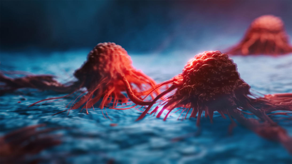  3D illustration of dark red cancer cells extending tendrils over blue tissue. 