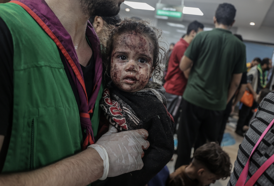 Scores of injured people were taken to Al-Shifa Hospital (Anadolu via Getty Images)