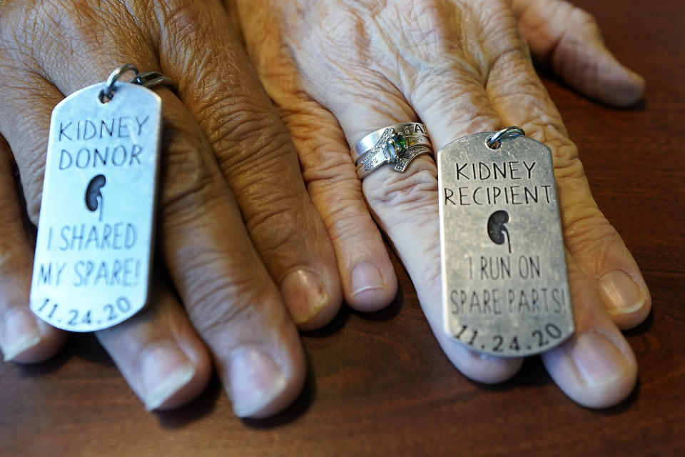 Debby-Neal Stricland and Mylaen Merthe show off donor/recipient tags they had made during a get together Tuesday, May 25, 2021, at a restaurant in Ocala, Fla. Debby now married to Jim Strickland donated a kidney to Mylaen Merthe, Jim's ex-wife. (AP Photo/John Raoux)