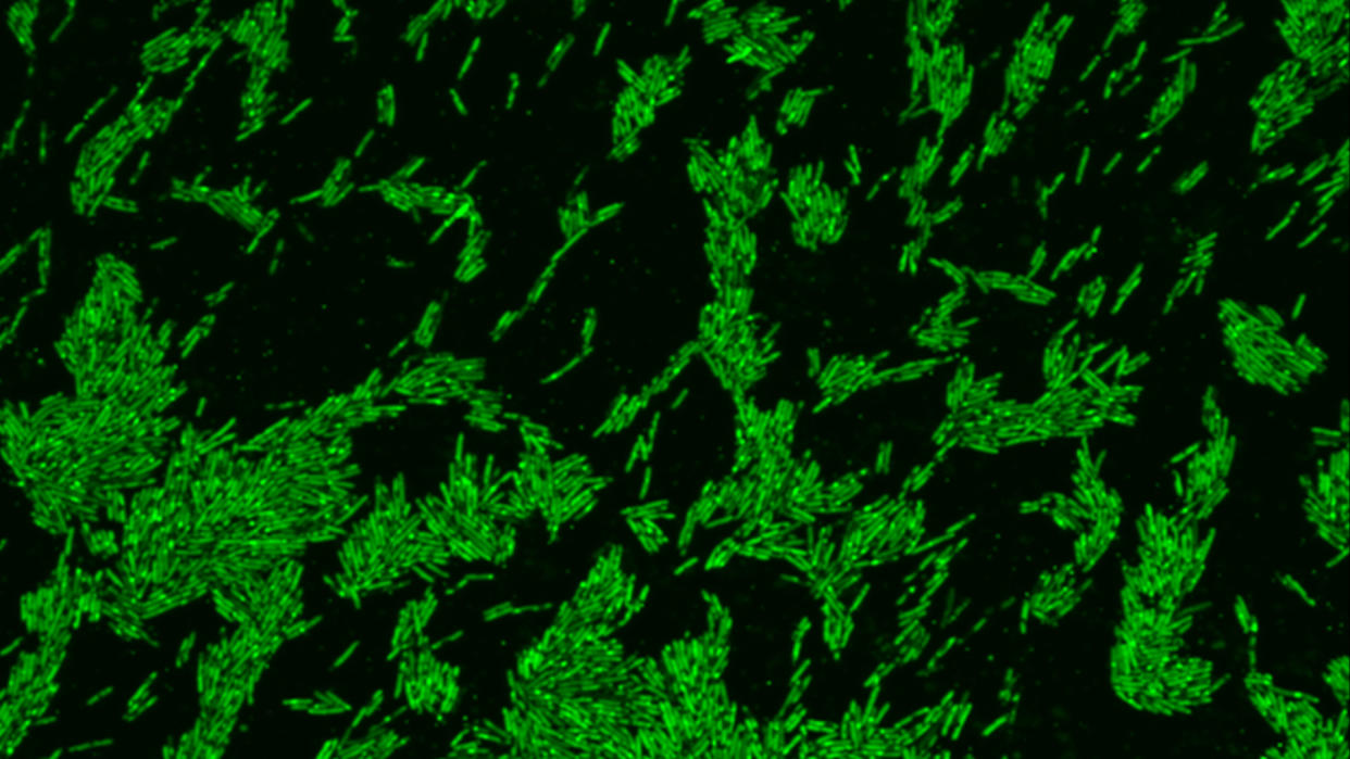  Microscopic image of bacterial cells full of bright green cholestorol molecules. 