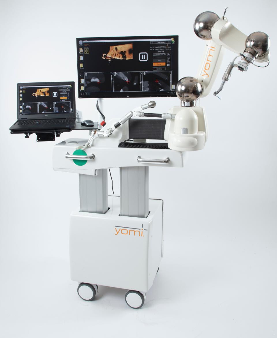 Using the Yomi Robotic Dental System by Neocis for dental implants is less invasive, said Dr. Jonas Gauthier. Patients also have a quicker recovery time allowing them to get back to work or school sooner than if had traditional implant surgery. They also experience less post-op discomfort.