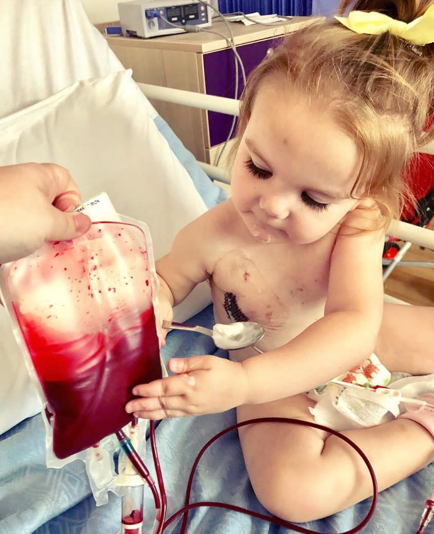 The two-year-old girl, from Scotland, is seen here with a bag of blood she is receiving while sitting on a hospital bed.