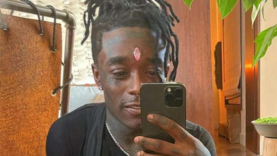 Lil Uzi Vert says fans ripped out pink diamond implant