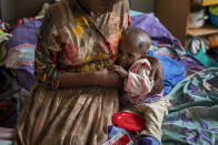 Tekien Tadese, 25, holds her baby, Amanuel Mulu, 22 months old, who is suffering from malnutrition and weighs only 6.7 kilograms (14 pounds and 12 ounces), at the Ayder Referral Hospital in Mekele, in the Tigray region of northern Ethiopia, on Monday, May 10, 2021. The child was unconscious when he was first admitted in April, severely malnourished and anemic after losing half his body weight. Two weeks in intensive care saved his life. (AP Photo/Ben Curtis)