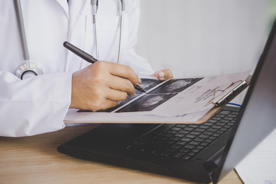 A doctor writes on an ultrasound paper over a laptop