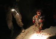 <p>Samar Hassan, 5, screams after her parents were killed by U.S. Soldiers with the 25th Infantry Division in a shooting January 18, 2005 in Tal Afar, Iraq. The troops fired on the Hassan family car when it unwittingly approached them during a dusk patrol in the tense northern Iraqi town. Parents Hussein and Camila Hassan were killed instantly, and a son Racan, 11, was seriously wounded in the abdomen. Racan, paralyzed from the waist down, was treated later in the U.S. (Photo by Chris Hondros/Getty Images) </p>