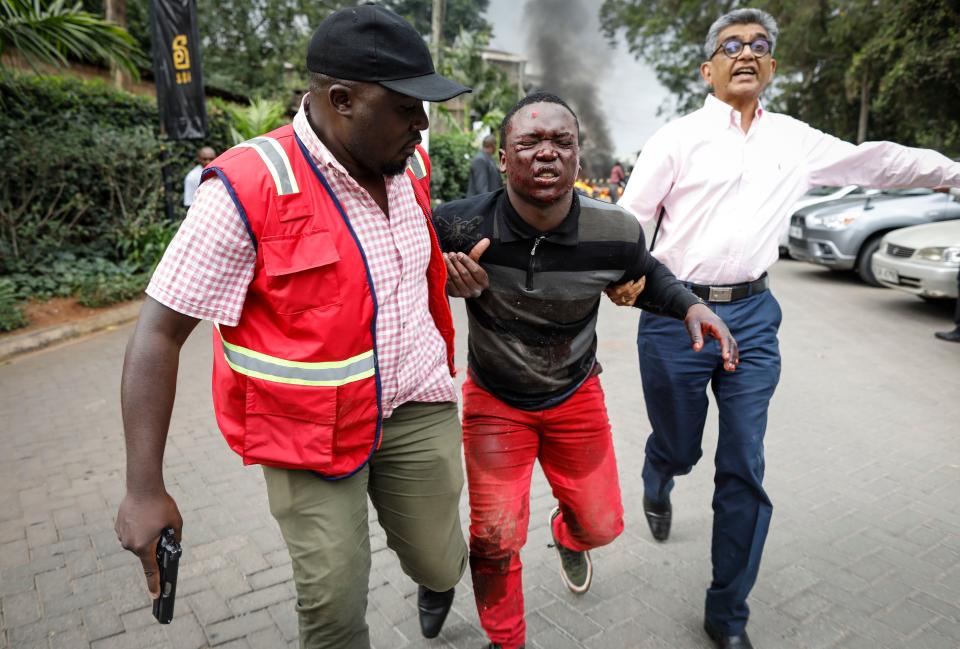 An injured man is escorted away by security officers during the attack in Nairobi, Kenya, Jan. 15, 2019. (Photo: Dai Kurokawa/EPA-EFE/REX/Shutterstock)