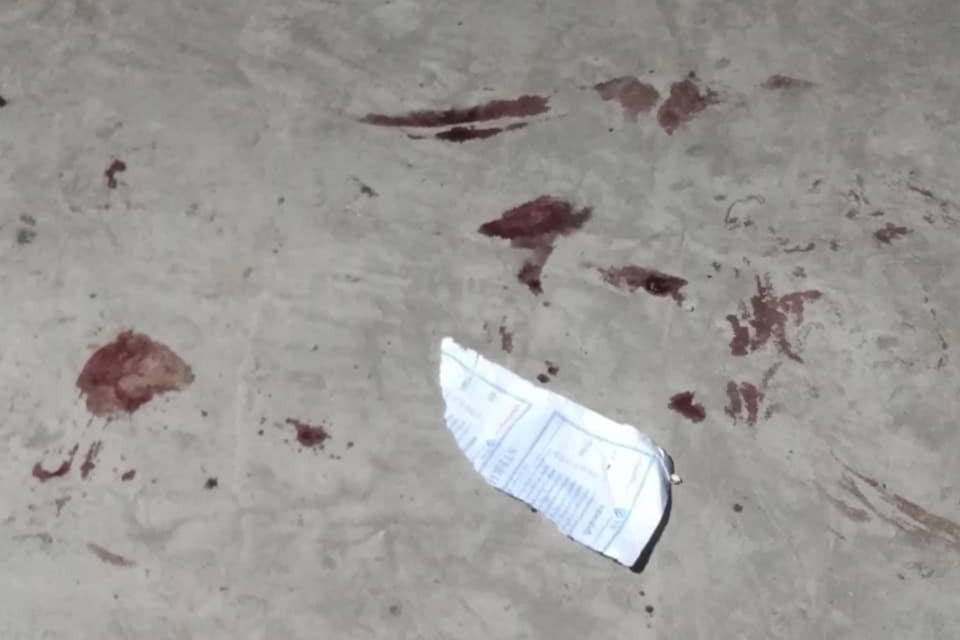 This March 21, 2021 photo obtained by The Associated Press shows blood stains left behind following a raid by Myanmar's security forces on an autobody shop in Yangon, Myanmar. The security forces shot a 15-year-old boy in the hand during the raid and hauled him away along with three other young men from the shop. The teenager's family says they were told he has been sentenced to three years in prison, one of thousands who have been arrested in a sweeping campaign by Myanmar's military to break the back of an uprising. (AP Photo)