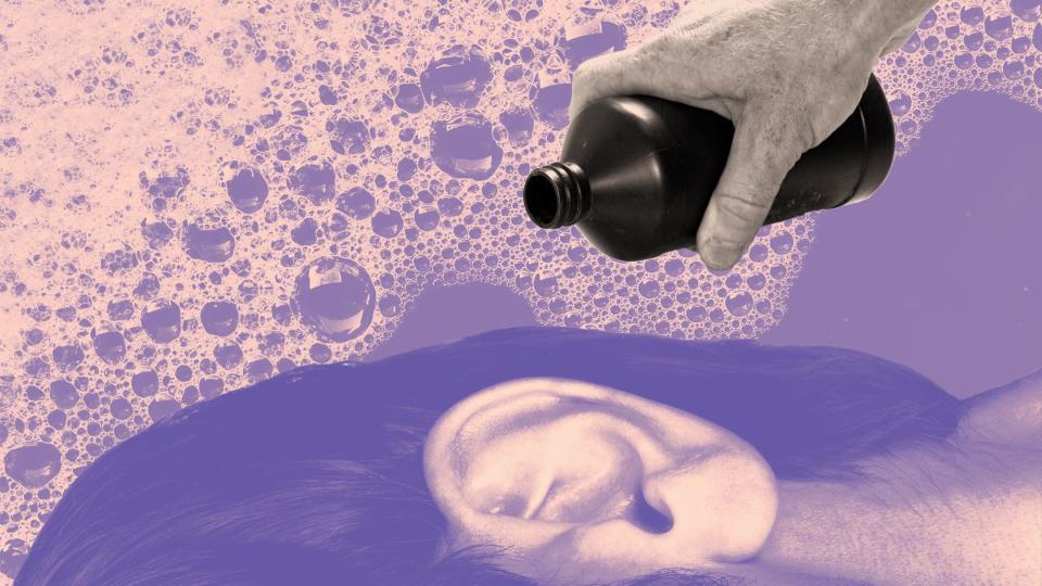 collage showing a person's hand pouring hydrogen peroxide into another person's ear for earwax removal