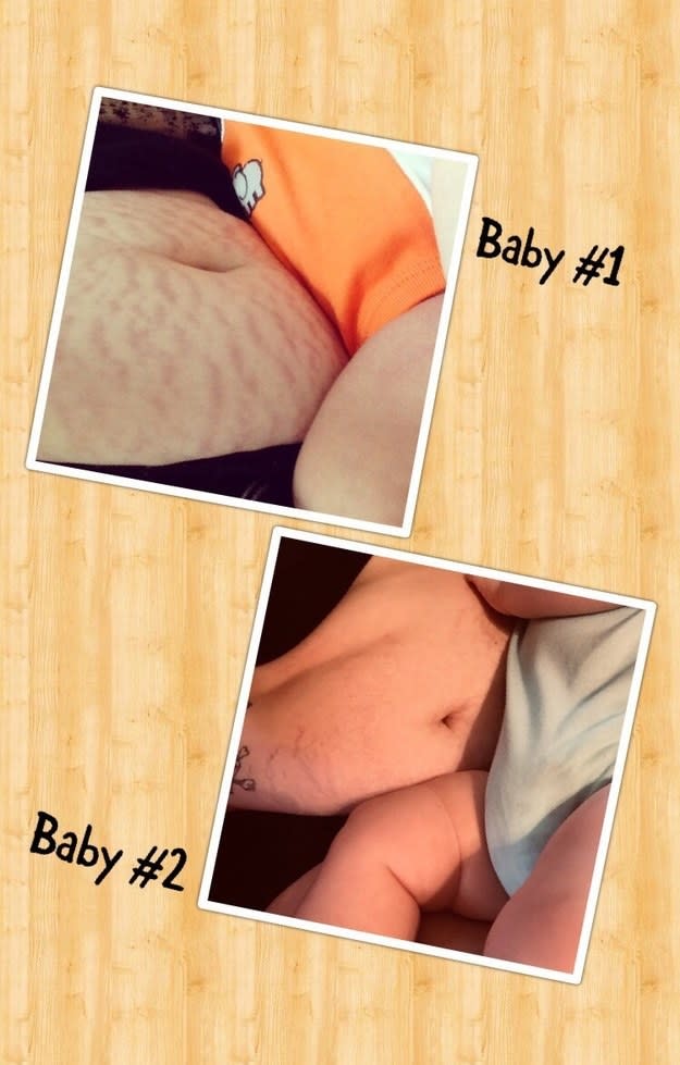 21 Awesome Photos That Show How Different Postpartum Bodies Can