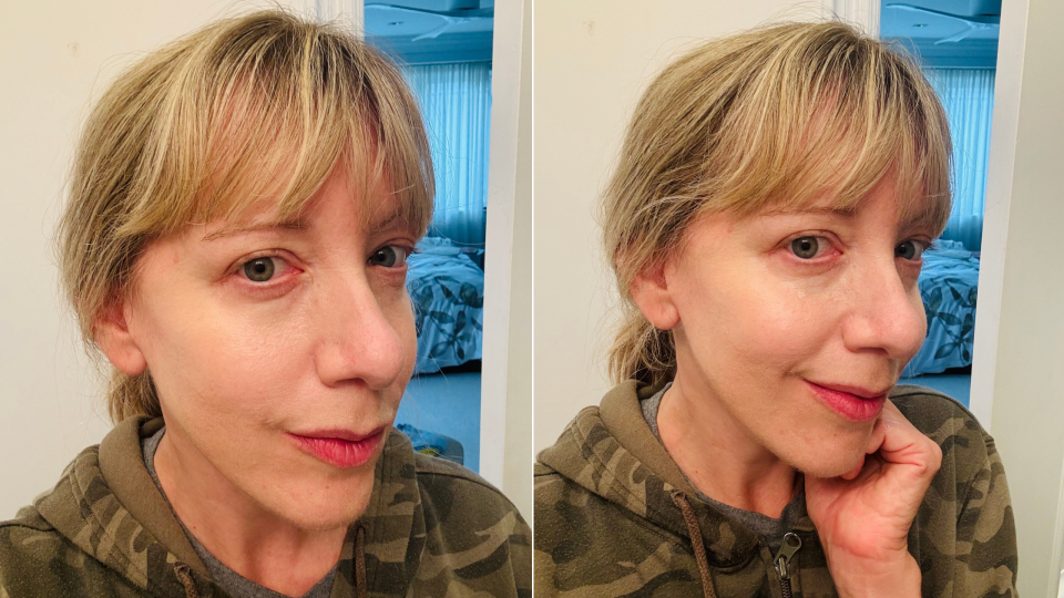 Before and after using the Eye Cream (Photos via Sarah DiMuro).