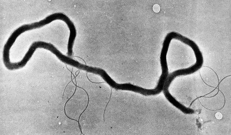 A Syphilis Outbreak Is Plaguing Las Vegas