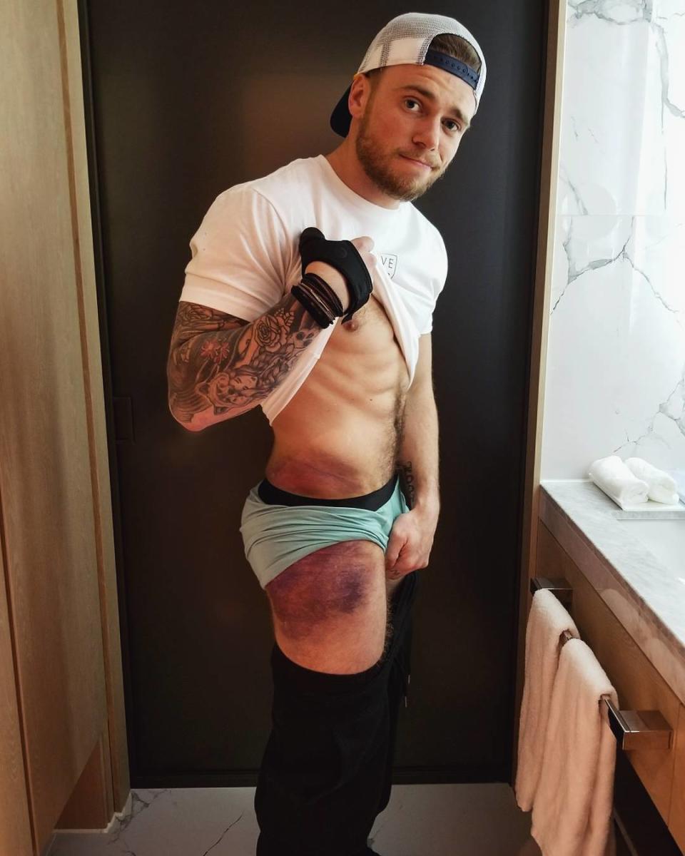 <p>guskenworthy: Just a bruised peach. (Photo via Instagram/guskenworthy) </p>