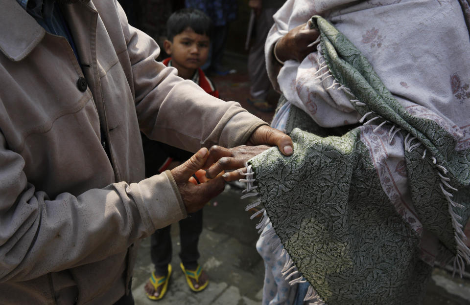 In this Sunday, Feb. 16, 2014 photo, an Indian man suffering from leprosy helps other leprosy affected woman at a leper colony in New Delhi, India. The stigma of leprosy endures in India, even though the country has made great strides against the disease, which is neither highly contagious nor fatal. Now the number of new annual cases has risen slightly after years of steady decline, and medical experts say the enormous fear surrounding leprosy is hindering efforts to finally eliminate it.(AP Photo/Manish Swarup)