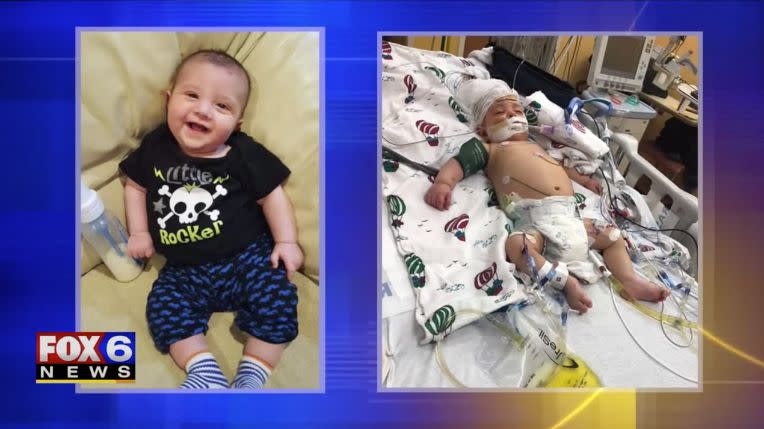 The parents of 5-month-old Marcus Albers are mourning his death after he became too ill for a liver transplant. (Photo: WITI)