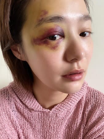 茵芙摔倒撞傷了眉骨，化妝師巧手蓋住傷勢。（圖／華人創作提供）