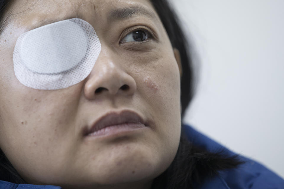 In this Wednesday, Dec. 4, 2019, photo, Veby Mega Indah, an injured Indonesian video journalist, speaks during an interview with The Associated Press in the Wan Chai area of Hong Kong. More than two months after being blinded in one eye by what she believes was a projectile fired by riot police, Indah is still seeking answers. On Sept. 29, 2019, Indah was among a group of reporters covering one of the hundreds of clashes between armed police and anti-government protesters that have broken out almost daily over the past six months. (AP Photo/Vincent Thian)