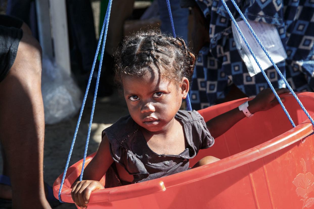 A small girl sits on a scale as a Doctors Without Borders mobile medical team measures her weight in the village of Befeno.