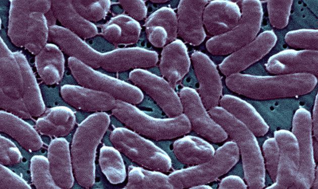Vibrio vulnificus is naturally occurring and lives in warm, brackish water. It can lead to life-threatening infections when people with an unhealed wound or cut come in contact with bacteria-ridden floodwater. (Photo: BSIP via Getty Images)
