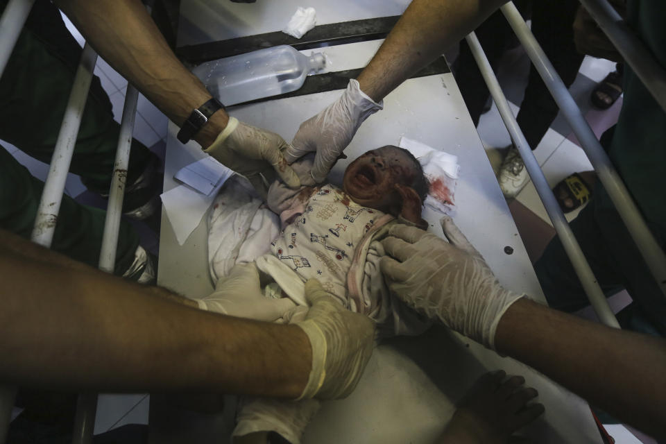 A wounded Palestinian baby receives treatment at the al-Shifa hospital, following Israeli airstrikes on Gaza City, central Gaza Strip, Monday, Oct. 23, 2023. (AP Photo/Abed Khaled)