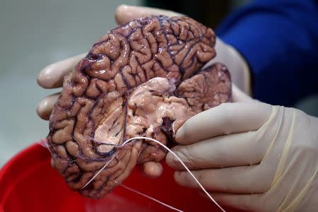 Dr. Vahram Haroutunian holds a human brain in a brain bank in the Bronx borough of New York City, New York, U.S. June 28, 2017. REUTERS/Carlo Allegri