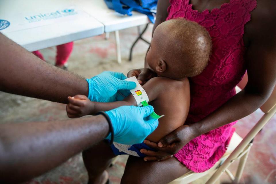 A healthcare worker measures the upper arm circumference of Chrisle Amboise 2, at a malnutrition clinic run by UNICEF, in Cité Soleil, Haiti, Sunday, Oct. 16, 2022.