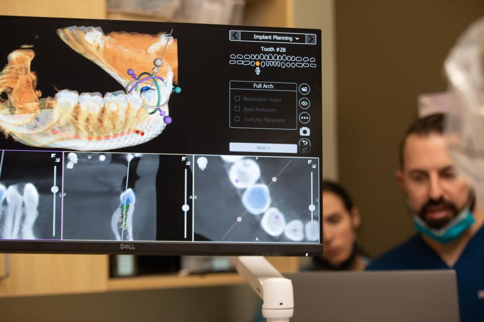 A computer monitor shows how CT and X-Ray scans of a patients' teeth help in aligning the YOMI robot to drill in just the right amount into a tooth for a dental implant procedure at Aspen Dental.