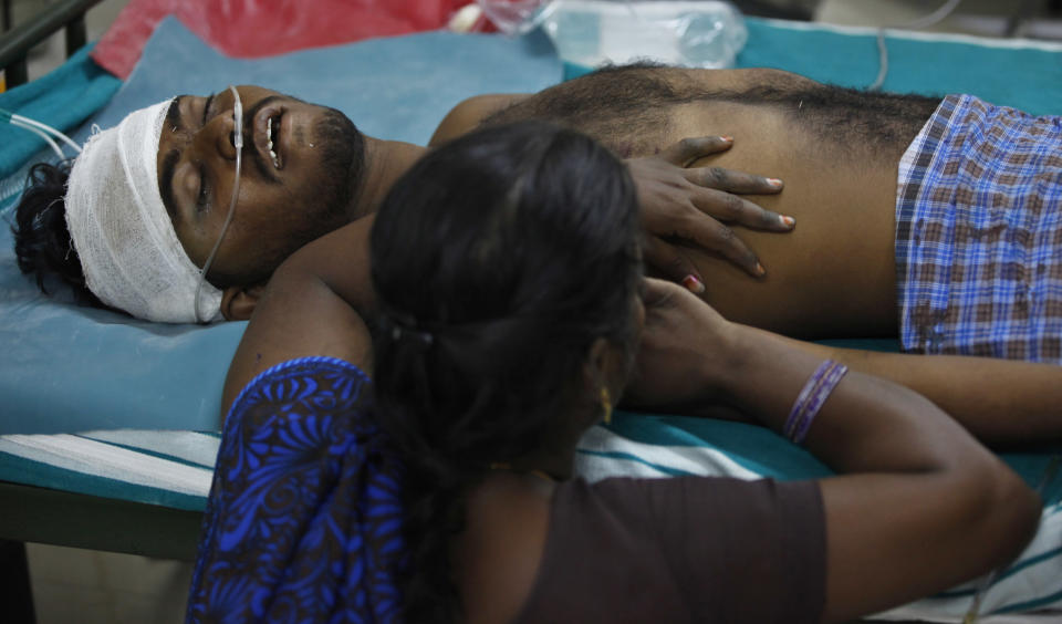 A woman holds on to her relative A. Marikannan, 22, injured with burns on his head and legs as he lies unconscious on a bed at a government run hospital in Madurai, about 460 kilometers (285 miles) southwest of Chennai, India, Thursday, Sept. 6, 2012. A massive blaze raged for hours at a fireworks factory in southern India, killing at least 40 workers and injuring 60 Wednesday, police said. Large amounts of firecrackers and raw materials had been stored in the Om Siva Shakti factory with major Hindu festivals weeks away. (AP Photo/Aijaz Rahi)