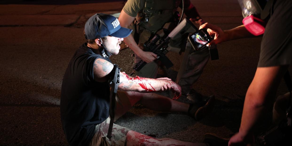 KENOSHA, WISCONSIN, USA - AUGUST 25: An armed civilian help a man, who was shot in the arm, as clashes between protesters and armed civilians who protect the streets of Kenosha against the arson during the third day of protests over the shooting of a black man Jacob Blake by police officer in Wisconsin, United States on August 25, 2020. (Photo by Tayfun Coskun/Anadolu Agency via Getty Images)