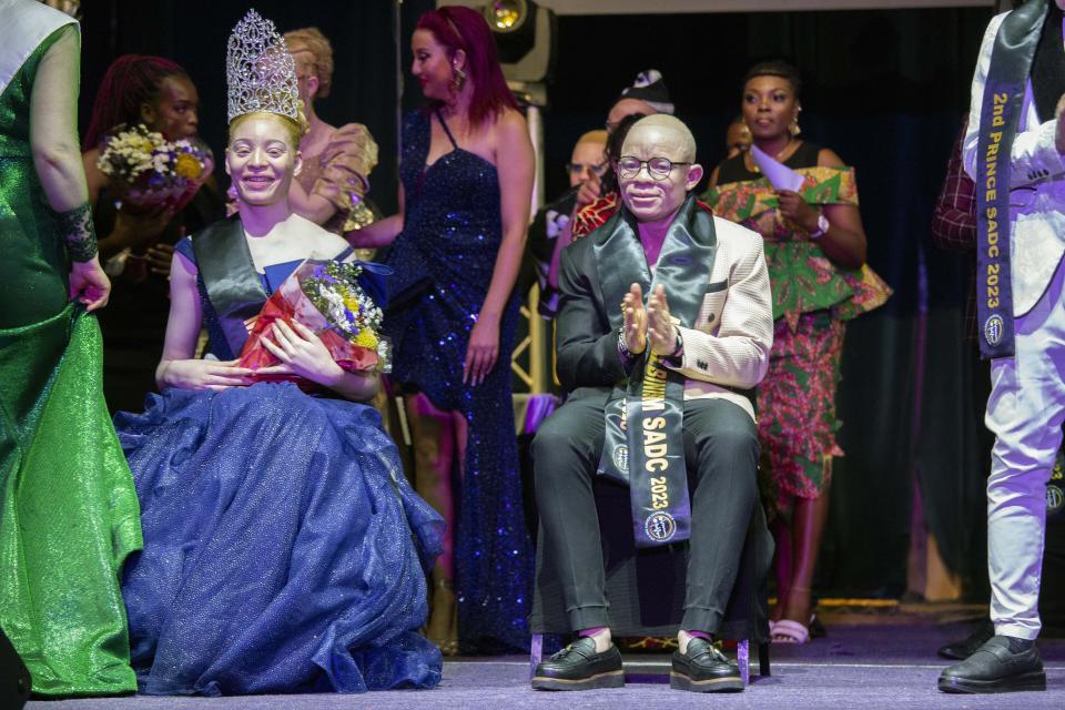 In this photo supplied by pageant organiser John Karimazonde of the Mr and Miss Albinism Southern Africa Pageant, the winners Andreia Solange Sicato Muhitu, left, and Ntandoyenkosi Mnkandla are seated, at the Harare International Conference Centre, Saturday Oct. 14, 2023. (Watson Ofumeli/Mr and Miss Albinism Southern Africa Pageant via AP)