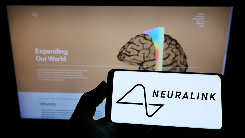 Neuralink, a startup from Elon Musk, earned FDA clearance to begin in-human clinical trials.