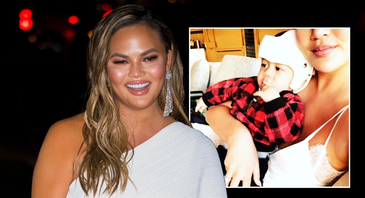 Chrissy Teigen took to social media to explain that her son Miles has to wear a corrective helmet for flat head syndrome [Photo: Getty/Twitter]