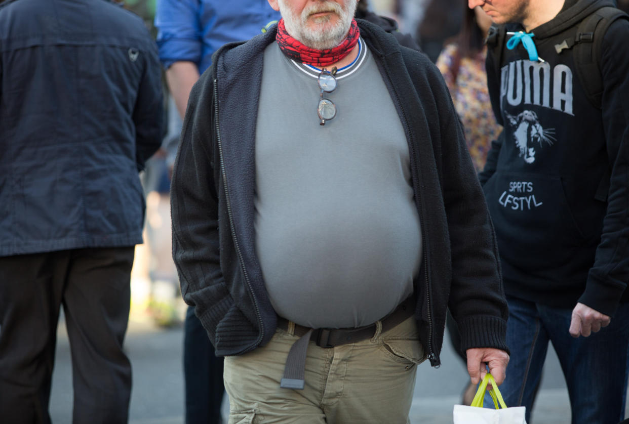 EMBARGID TO 1600 THURSDAY MAY 6 Undated file photo of an obese man in London. Obese men are at greater risk of severe Covid-19 and death than obese women, research has suggested. Issue date: Thursday May 6, 2021.