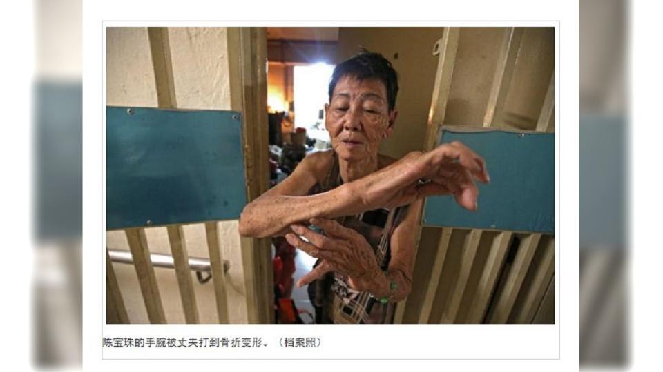 新加坡一名7旬婦人遭丈夫家暴超過40年，打到肋骨斷裂手部變形，卻還是深愛著對方。(圖／翻攝自中國報)