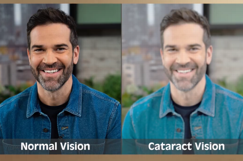 The BBC demonstrated the impact of cataracts on vision