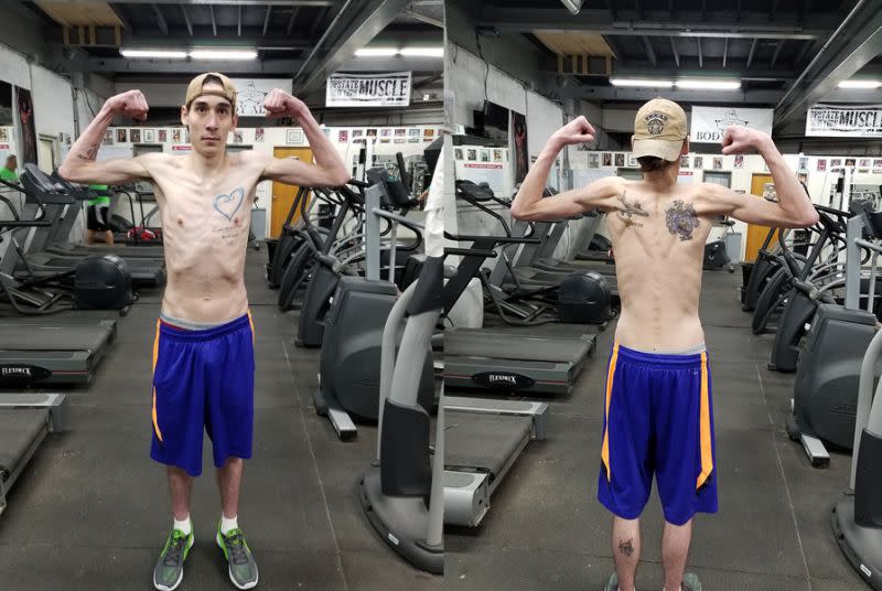 Jared Wells, 21 ans, est atteint d’un cancer du poumon et partage son parcours fitness. (Photo : Body Alive via Facebook)