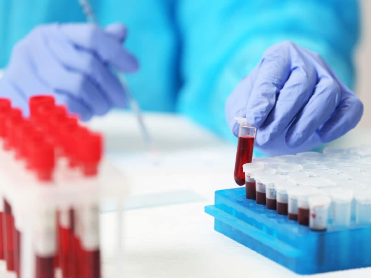 Dynalife Medical Labs was expected to take over delivery of community lab services from Alberta Precision Laboratories on July 1. The takeover has been delayed until December, AHS says.  (Shutterstock - image credit)