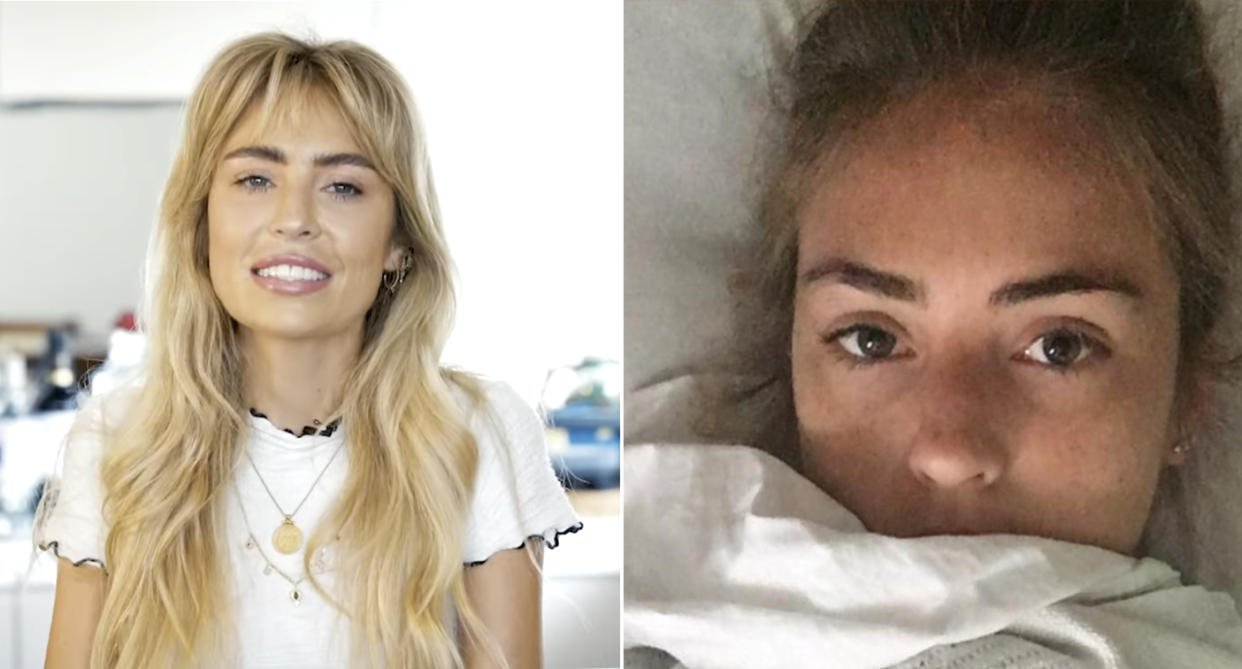 Left, model Emily Gurr home in Australia. Right, Emily Gurr in hospital with dengue fever.