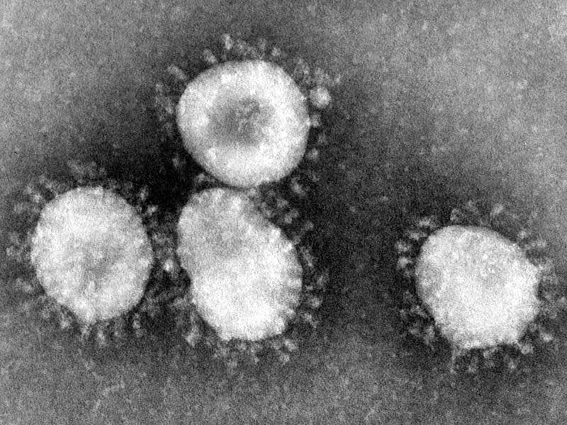 Das Mers-Virus wurde nach bisheriger Erkenntnis schon seit etlichen Jahren unerkannt von Kamelen auf Menschen übertragen. Foto: Center for Disease Control